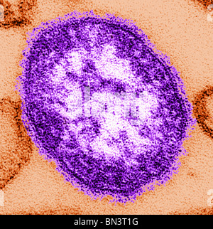 Dünn-Abschnitt Übertragung Elektronen Schliffbild (TEM) einer einzigen Viruspartikel oder "Virion" des Masern-virus Stockfoto