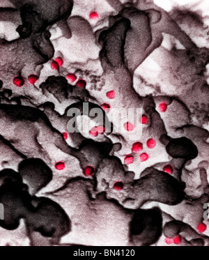 Eingefärbte scanning Electron Schliffbild des menschlichen Immunodeficiencyvirus (HIV), angebaut in kultivierten Lymphozyten Stockfoto