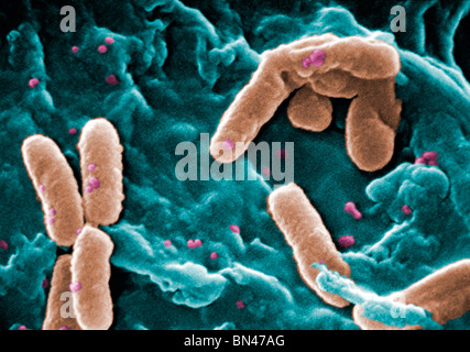 Eingefärbte scanning Electron Schliffbild (SEM) von Pseudomonas Aeruginosa Bakterien Stockfoto