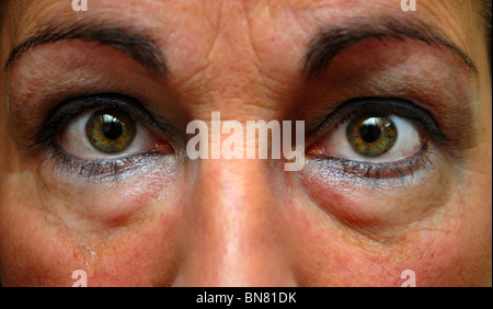 Nahaufnahme Foto von in an Schlaflosigkeit Augen mit Eyeliner auf. Stockfoto