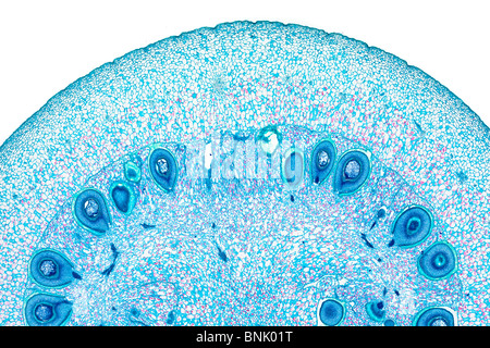 Brightfiedl Mikrophotographie Kartoffel Obst befleckt Abschnitt (LS)-Detailansicht Stockfoto