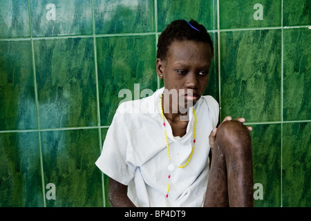 Im Hospiz in den Slums von Port-au-Prince, Haiti Cité Soleil ist eine neunzehn Jahre alt haitianischen Mädchen an AIDS sterben. Stockfoto