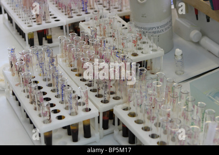 WESTLICHEN Sibirien, Russland, 2009: Clinical-hämatologischen Labor für klinische Regionalkrankenhaus in Tomsk. Stockfoto