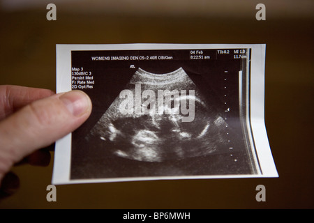 Ultraschall eines menschlichen Fötus Stockfoto
