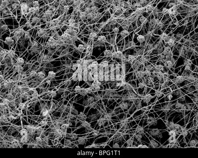 Ein scanning Electron Schliffbild (SEM) von Stachybotrys Chartarum, ein grünlich schwarz Cellulotytic Pilz Stockfoto