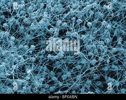 Ein scanning Electron Schliffbild (SEM) von Stachybotrys chartarum Stockfoto