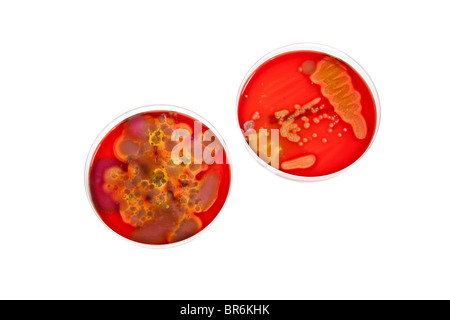 Petrischalen mit verschiedenen Stufen der Bakterien Kulturen Stockfoto