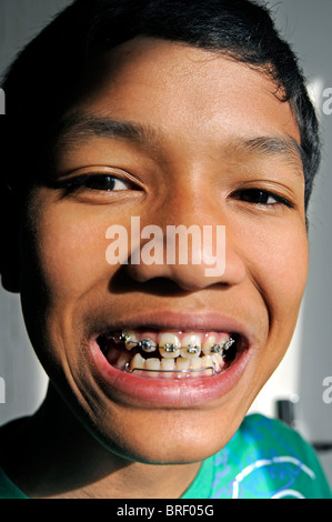 Junge mit Kieferorthopädie Zahnspange, 12 Jahre alt Stockfoto