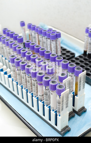 viele Reagenzgläser mit Fremdblut getestet Stockfoto