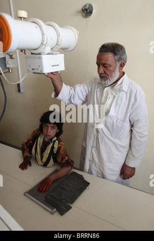 Röntgenaufnahmen des verletzten Zivilisten in Afghanistan Stockfoto