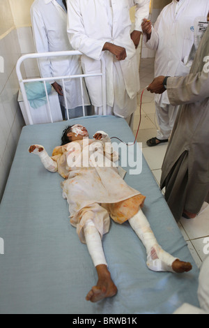 Opfer von einem IED-Anschlag in Afghanistan Stockfoto