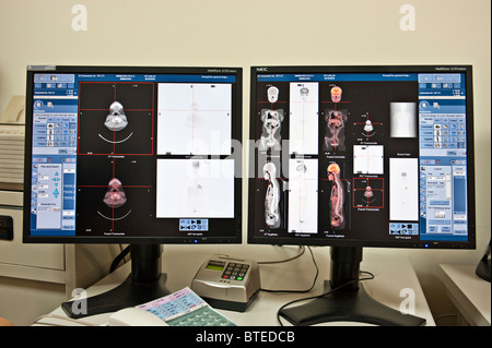 PET-CT Diagnostik medizinische Scanner Bilder auf Computer-Monitore, Nahaufnahme Stockfoto