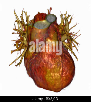 3D CT-Scan des Kopfes eines älteren Mannes Stockfoto