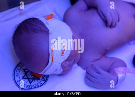 Neugeborenes Baby, das Fototherapie auf der Entbindungsstation des Bikur Cholim Hospitals, einer Zweigstelle des Shaare Zedek Medical Center, in Jerusalem, Israel, hat Stockfoto