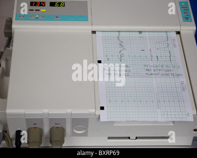 Die fötaler Herzmonitor berechnet und zeichnet die fetale Herzfrequenz auf ein kontinuierlicher Streifen Papier. Stockfoto