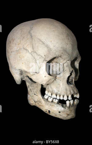 Seitenansicht eines menschlichen Schädels Stockfoto