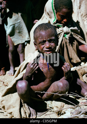 Opfer der Hungersnot in Darfur Sudan Afrika Stockfoto