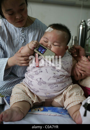 Gewicht sorgen für übergewichtige BABY wiegt dieses großen Baby eine enorme 19 Kilogramm (42 Pfund). Liu Yuqing war nur 2,5 Stockfoto