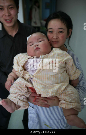 Gewicht sorgen für übergewichtige BABY wiegt dieses großen Baby eine enorme 19 Kilogramm (42 Pfund). Liu Yuqing war nur 2,5 Stockfoto