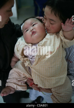 Gewicht sorgen für übergewichtige BABY wiegt dieses großen Baby eine enorme 19 Kilogramm (42 Pfund). Liu Yuqing war nur 2,5 Stockfoto