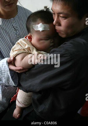 Gewicht sorgen für übergewichtige BABY wiegt dieses großen Baby eine enorme 19 Kilogramm (42 Pfund). Liu Yuqing war nur 2,5 Stockfoto