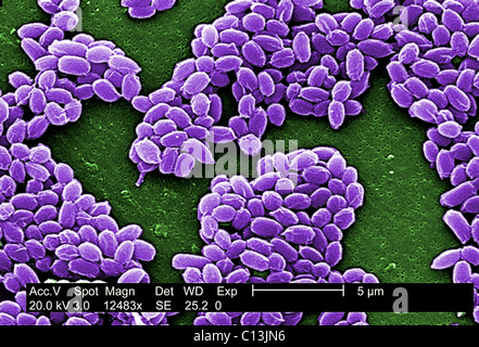 Sporen von einem Milzbrandbakterien. Diese Sporen Leben seit vielen Jahren die Bakterien in einem schlafenden Zustand überleben. Foto: Stockfoto