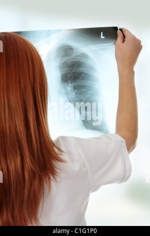 Ärztin untersucht eine Brust Röntgen Foto scannen. Stockfoto