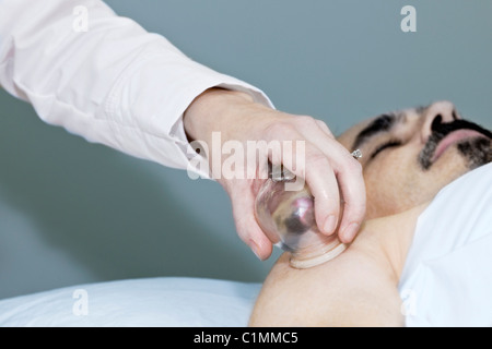 Anwenden von Schröpfen Therapie in der traditionellen chinesischen Medizin auf Schulter des Mannes Stockfoto