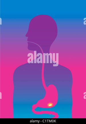 Mann zu schlucken, Pille, Querschnitt, illustration Stockfoto
