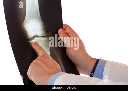 Doktor der Medizin zeigt mit Finger auf Röntgenbild des Knies gemeinsame Knochen. Isoliert auf weißem Hintergrund. Stockfoto