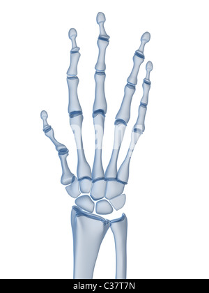 Röntgen-Hände - arthritis Stockfoto