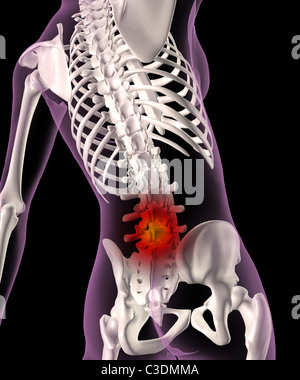 3D Render von einem weiblichen medizinische Skelett mit der Basis der Wirbelsäule Rückenschmerzen Darstellung hervorgehoben Stockfoto