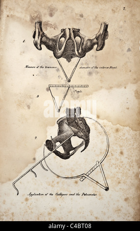 Abbildung des menschlichen Beckens copyright 1844 Stockfoto