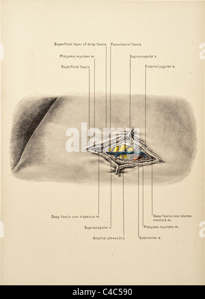 Illustration des menschlichen Hals Arterien copyright 1904 Stockfoto