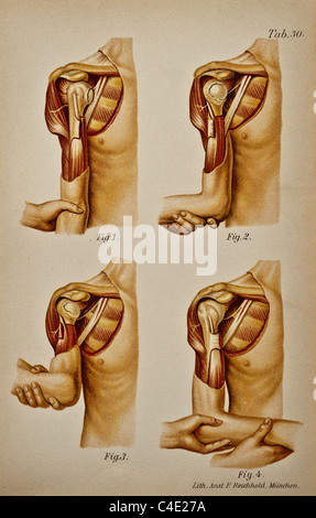 Abbildung der menschlichen Schulter copyright 1902 Stockfoto