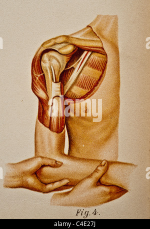 Abbildung der menschlichen Schulter copyright 1902 Stockfoto