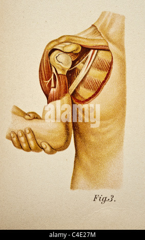 Abbildung der menschlichen Schulter copyright 1902 Stockfoto