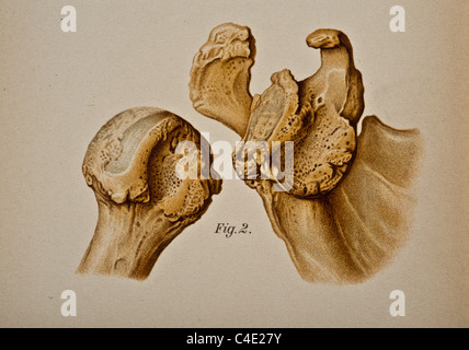 Abbildung der menschlichen Schulter copyright 1902 Stockfoto