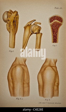 Abbildung der menschlichen Schulter copyright 1902 Stockfoto