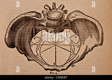 Antike medizinische Illustration der Becken-Knochen Stockfoto