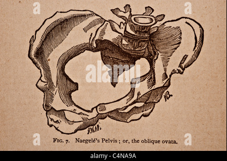 Antike medizinische Illustration der Becken-Knochen Stockfoto