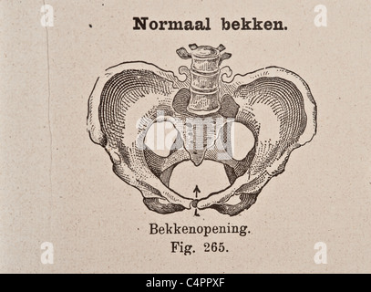 Antike medizinische Illustration der Becken-Knochen Stockfoto
