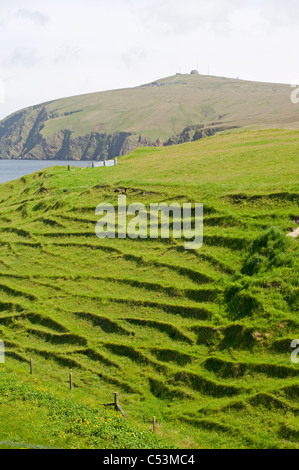 Erosion der schrägen Boden auf der Insel Unst durch regelmäßigen Gebrauch von Schafen. Shetland-Inseln. SCO 7475 Stockfoto