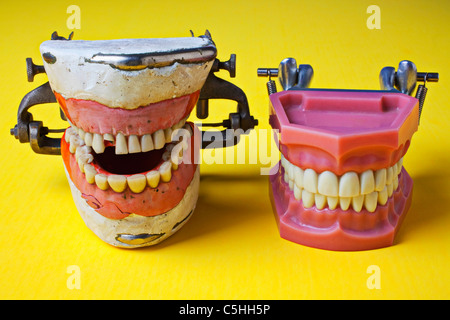 Dental-Modelle, schlechte Zähne, gute Zähne Stockfoto