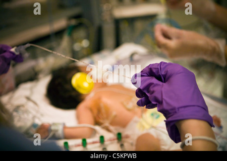 Vorzeitigen Neugeborenen auf der Intensivstation.  Frühchen auf der Intensivstation.  Intensivmedizinischen Versorgung von Frühgeborenen. Stockfoto