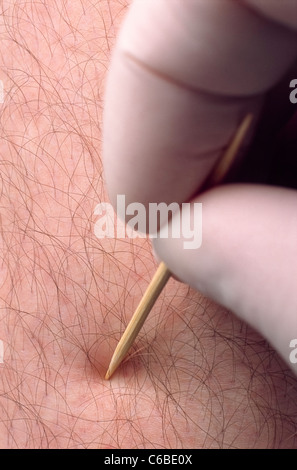 Ein Neurologe eine sensorische Prüfung am Bein des Patienten mit einem Zahnstocher. Stockfoto