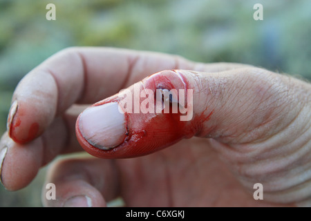 Schnitt und blutenden Daumen bei einem Sturz auf einem Felsen Stockfoto