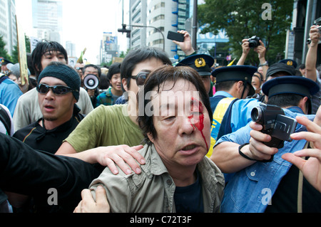 Ein Mann in ein Handgemenge mit der Polizei verletzt ist von anderen Demonstranten bei einer Anti-Atom-Protest anlässlich des 6-monatigen betreut. Stockfoto