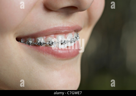 Ein Lächeln auf den Lippen Teenager mit Zahnspangen, ECU Stockfoto