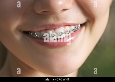 Ein Lächeln auf den Lippen Teenager mit Zahnspangen, ECU Stockfoto